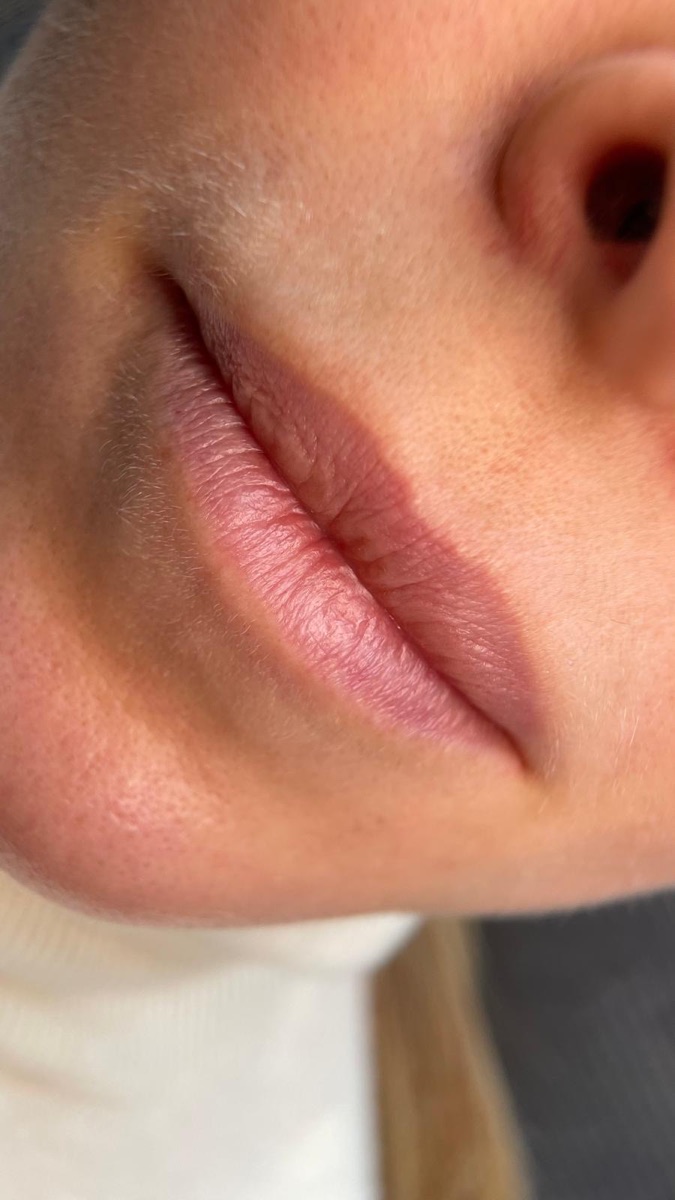 Lippen vorher – blasse natürliche Lippenfarbe, undeutliche Kontur