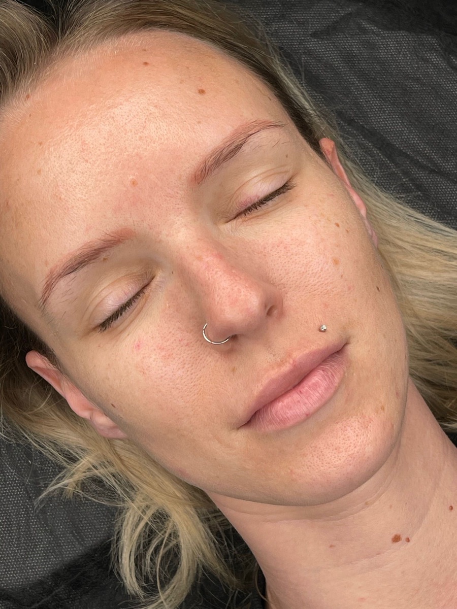 Gesicht mit hellen, kaum sichtbaren Augenbrauen vor Powder Brows Behandlung